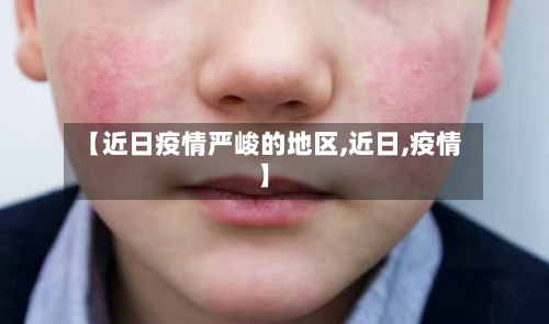【近日疫情严峻的地区,近日,疫情】