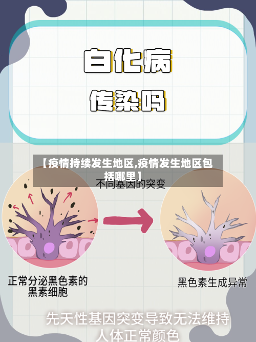 【疫情持续发生地区,疫情发生地区包括哪里】