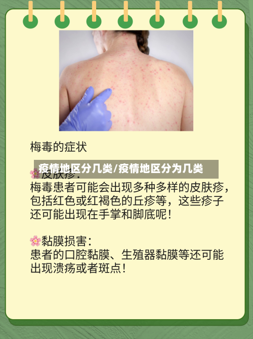疫情地区分几类/疫情地区分为几类