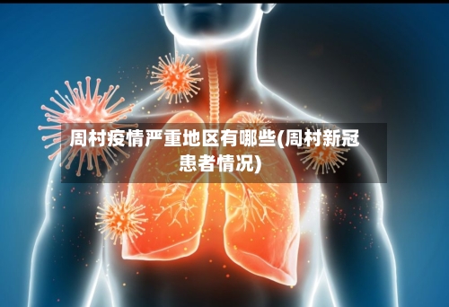 周村疫情严重地区有哪些(周村新冠患者情况)