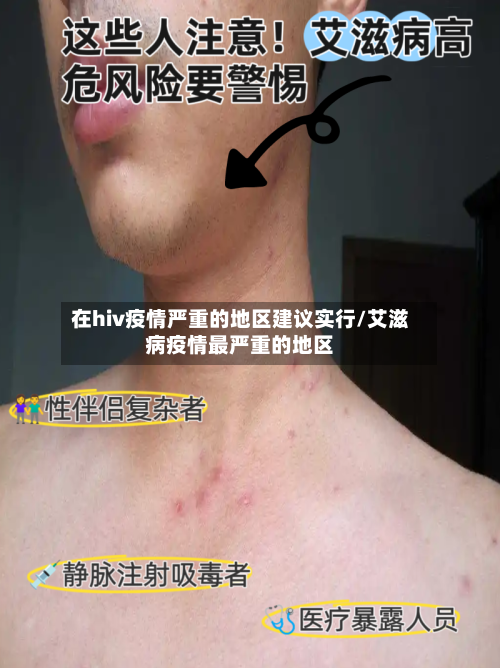 在hiv疫情严重的地区建议实行/艾滋病疫情最严重的地区