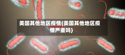 美国其他地区疫情(美国其他地区疫情严重吗)